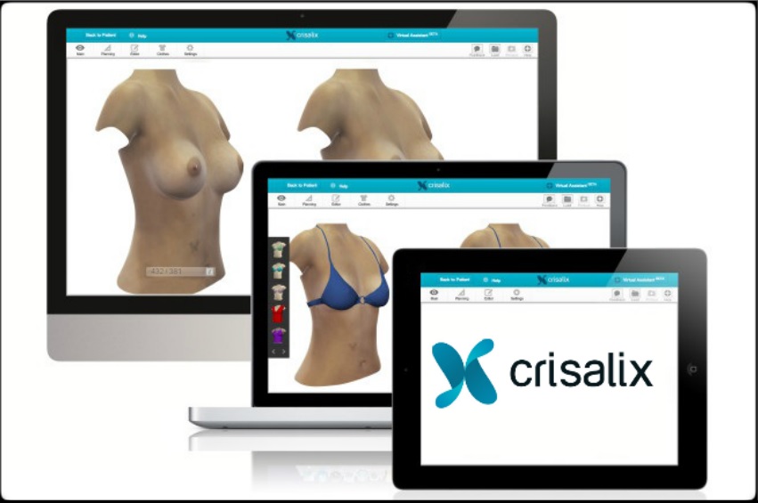 Crisalix-3D-Brustvergroesserungen simulieren fuer eine bessere Ansicht und mehr kontrolle